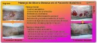 Tratamiento de la úlcera venosa en el paciente diabético