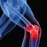 Causas y tratamiento del dolor de rodilla