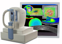 El OCT da imágenes de la retina con una resolución extremadamente alta