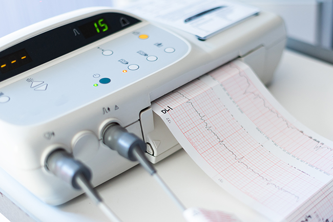 Equipo de electrocardiograma para estudiar la función eléctrica del corazón